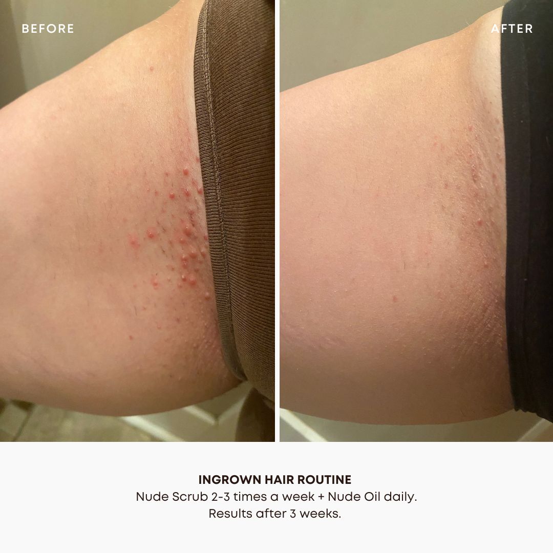 Exfoliating Bikini Scrub