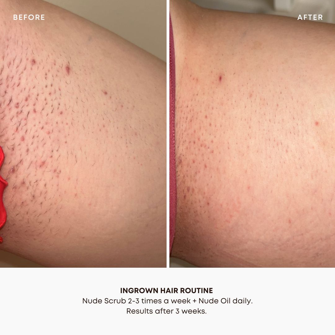 Nude Ingrown Hair Oil by Bushbalm