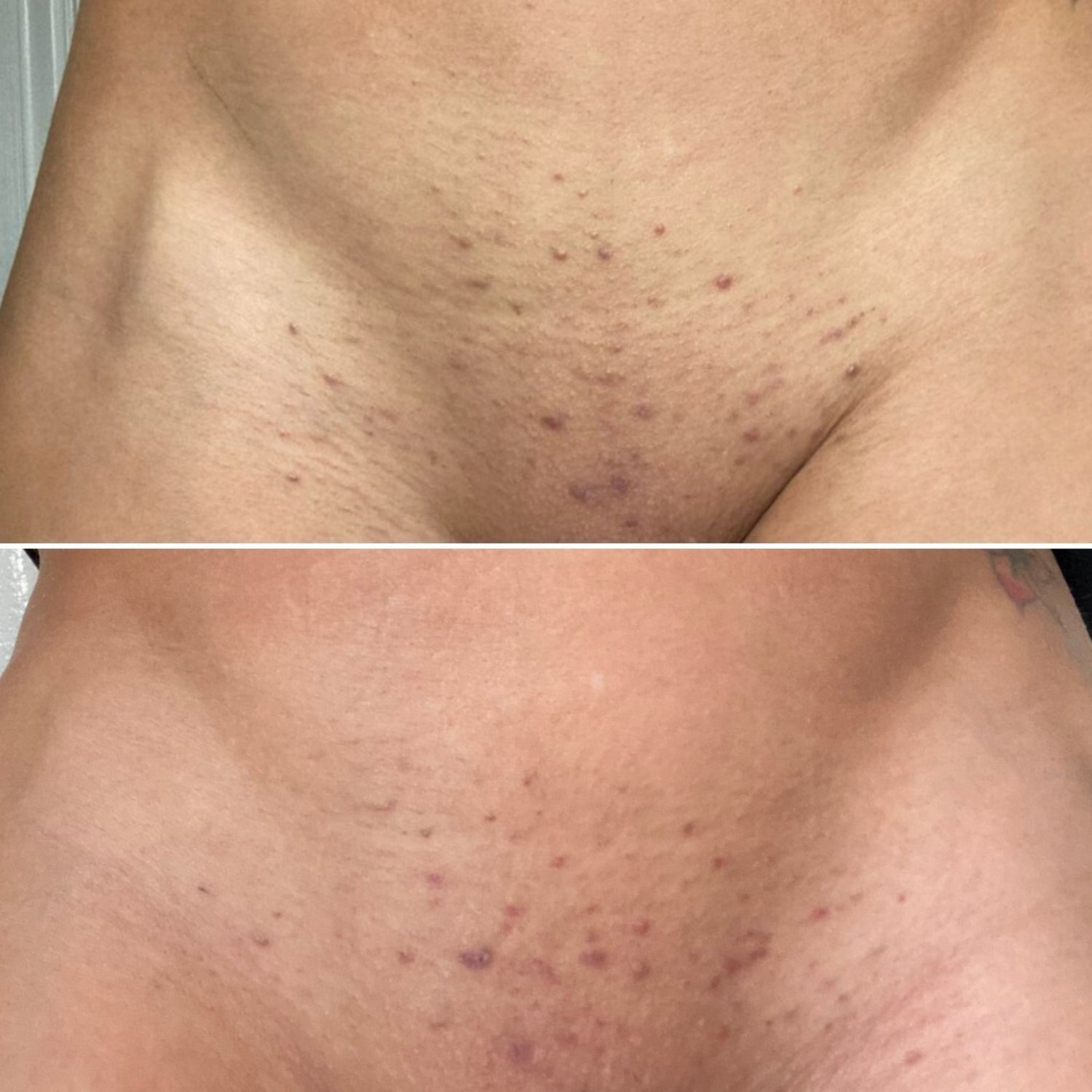 25 - Before and After