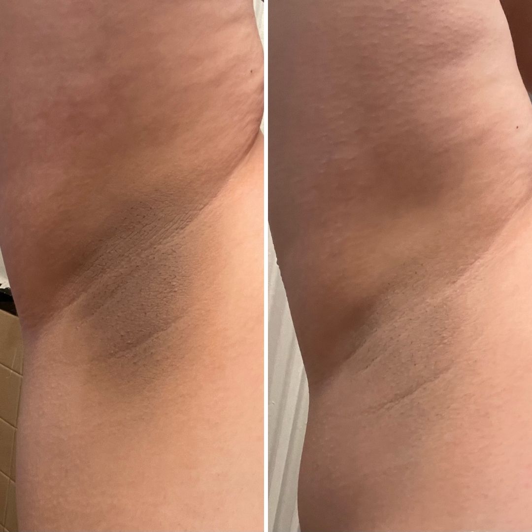 41 - Before & After