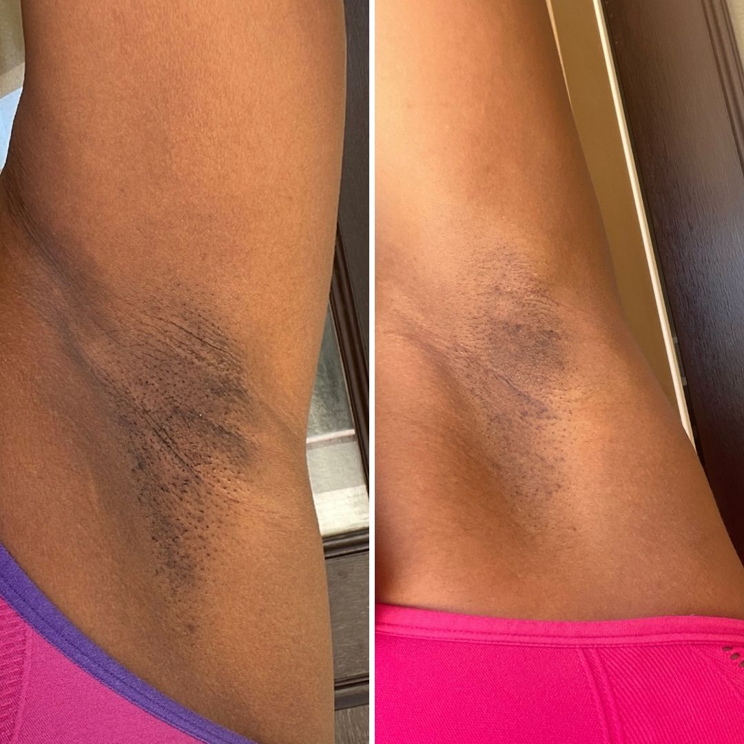 36 - Before & After