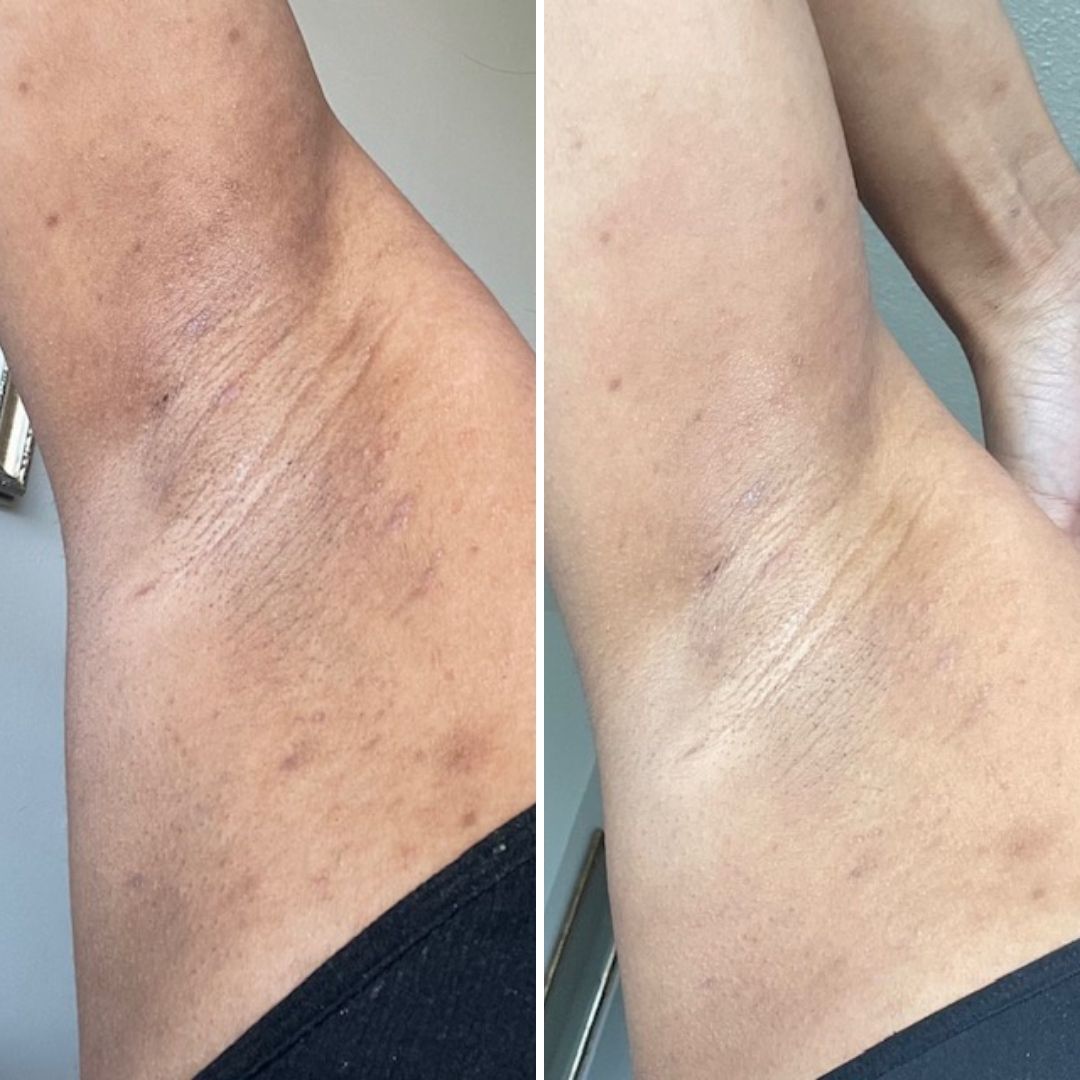 38 - Before & After