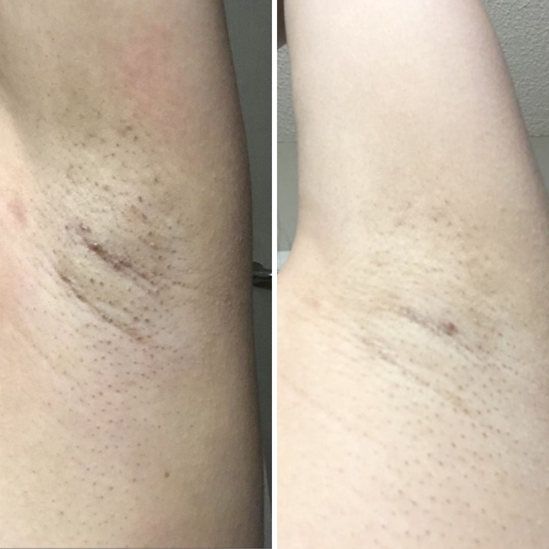 Before & After image closeup Bushbalm