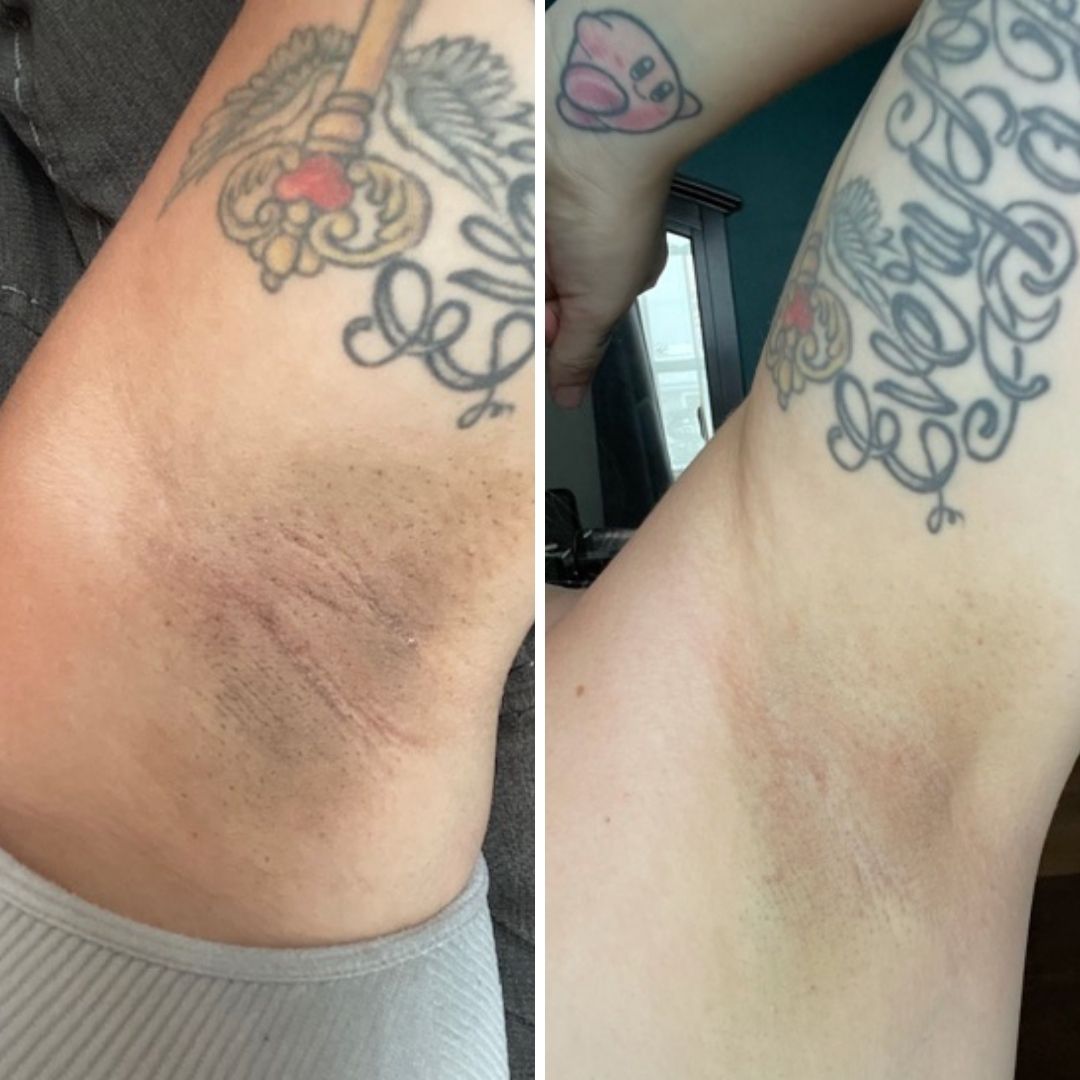 Before & After image closeup Bushbalm