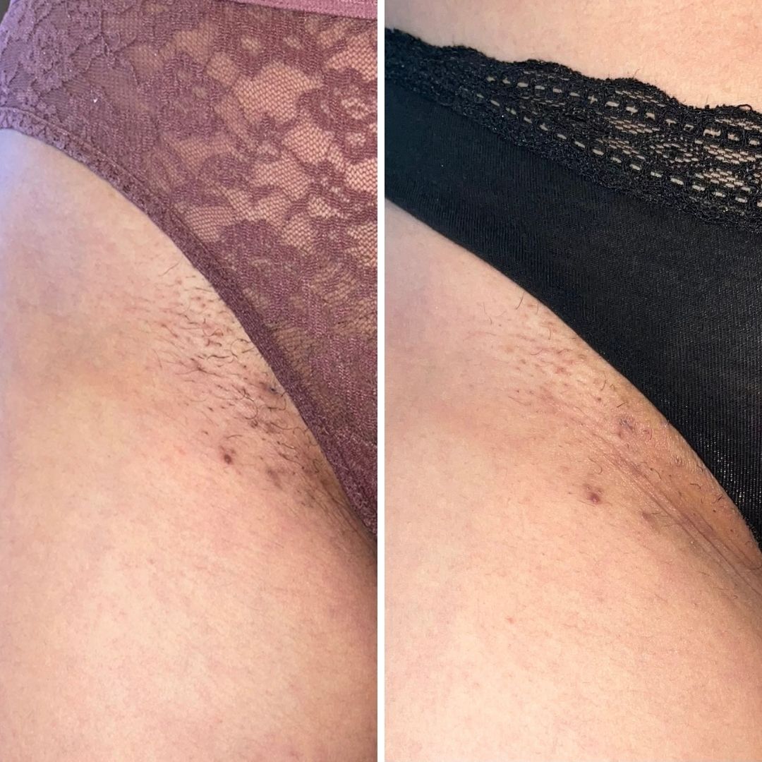 Before & After image closeup Bushbalm