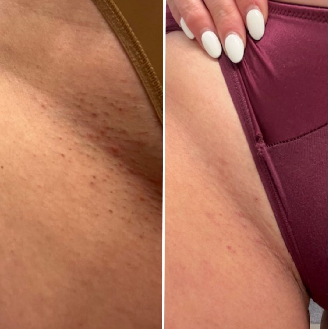 35 - Before & After