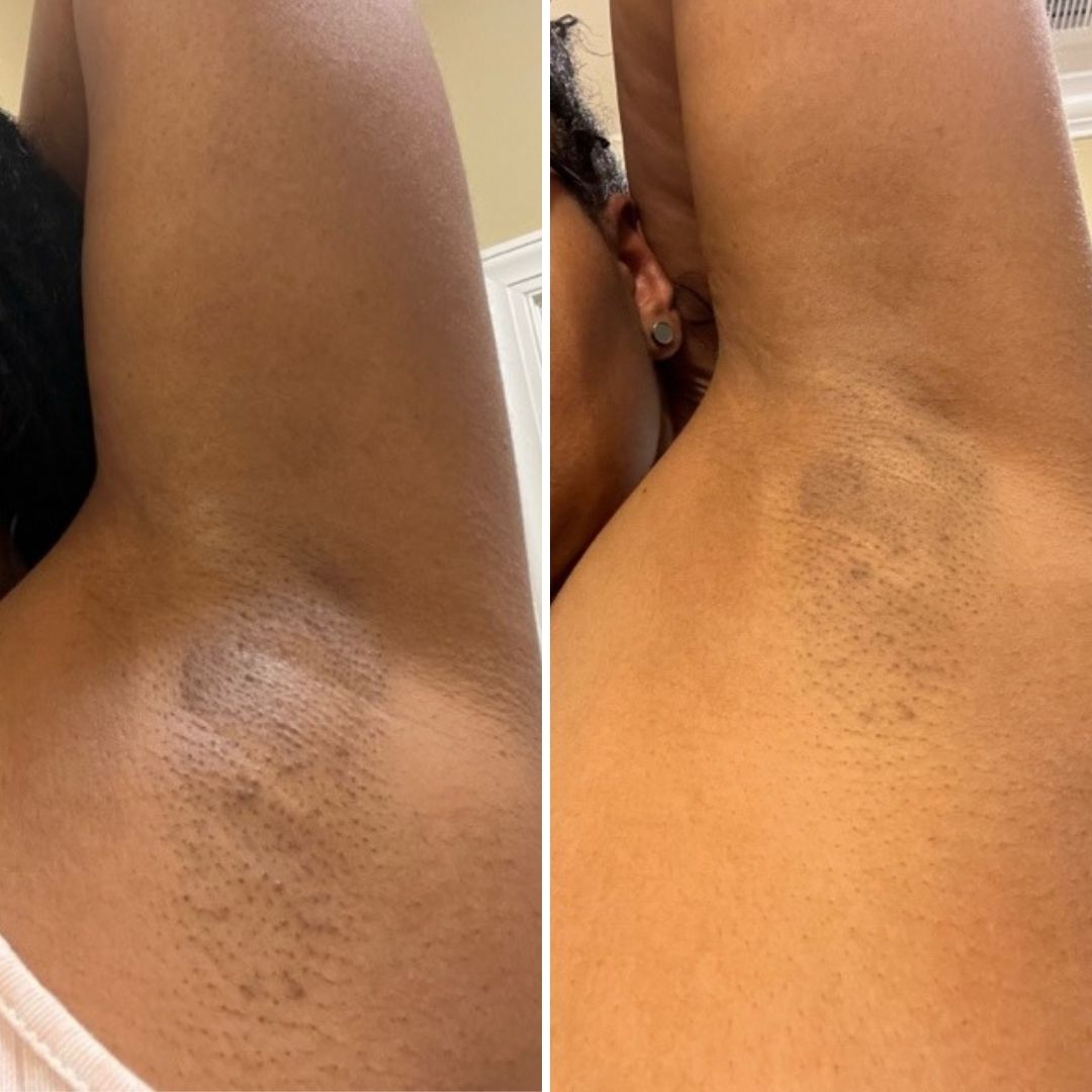 42 - Before & After
