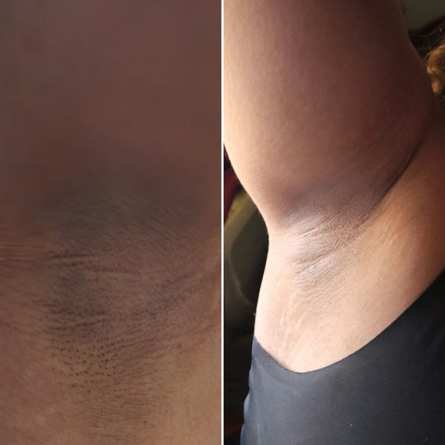 21 - Before and After