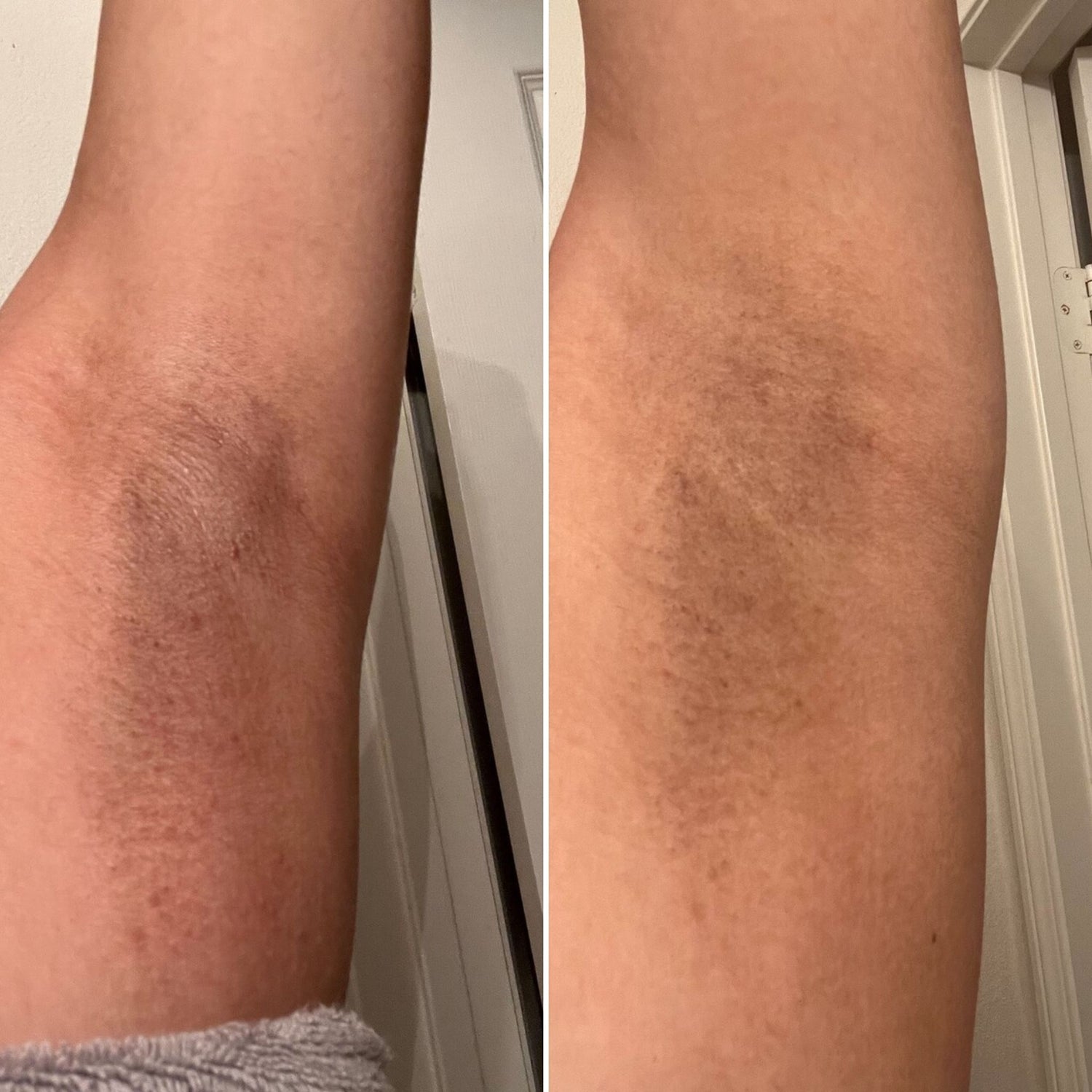 22 - Before and After