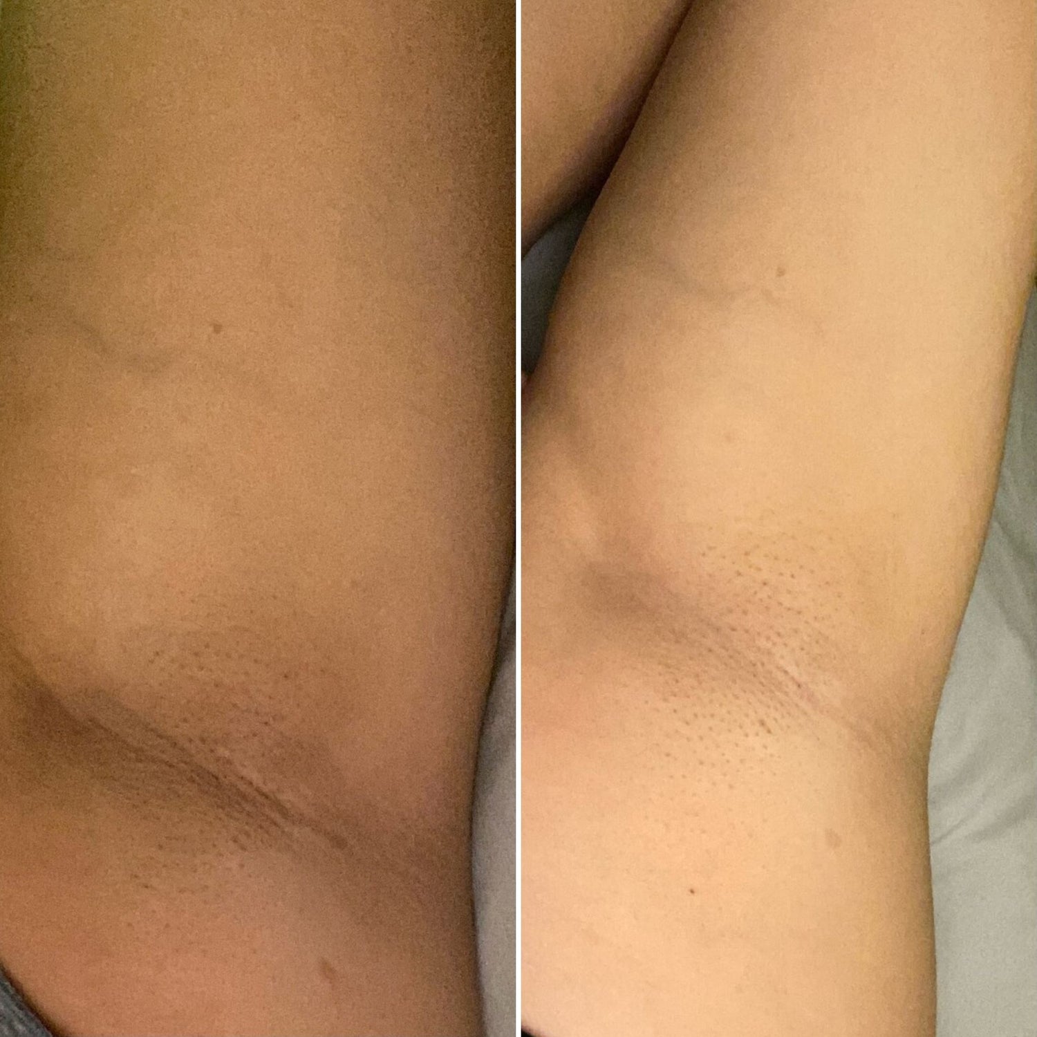 23 - Before and After