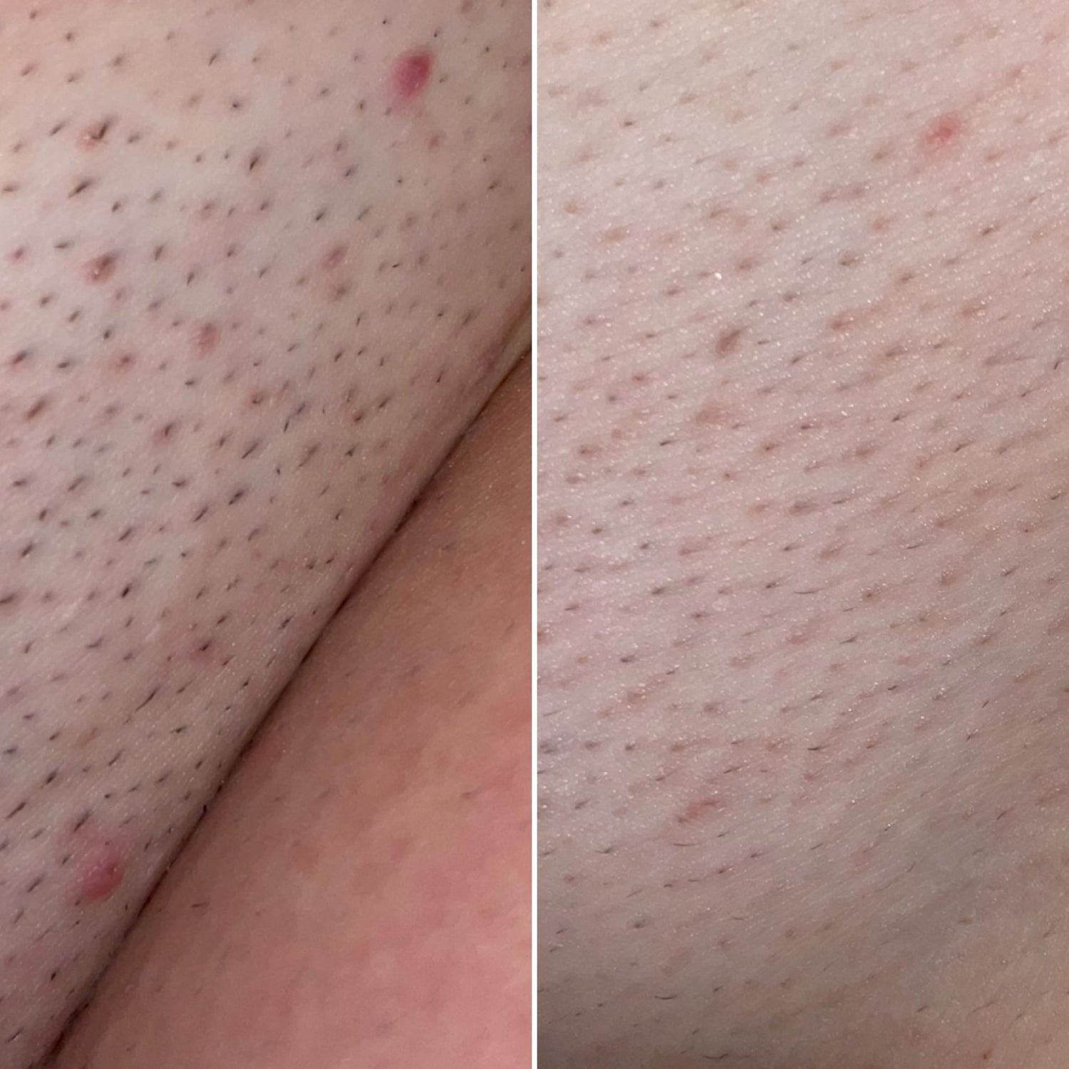 32 - Before & After