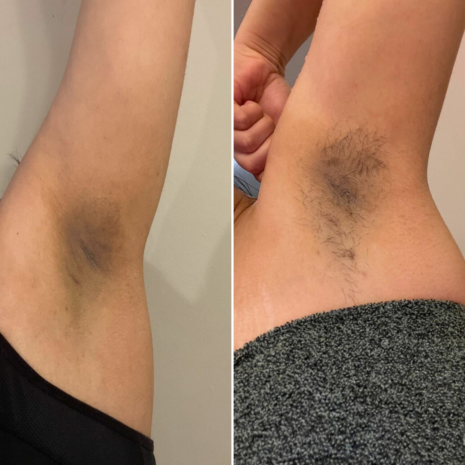 33 - Before and After