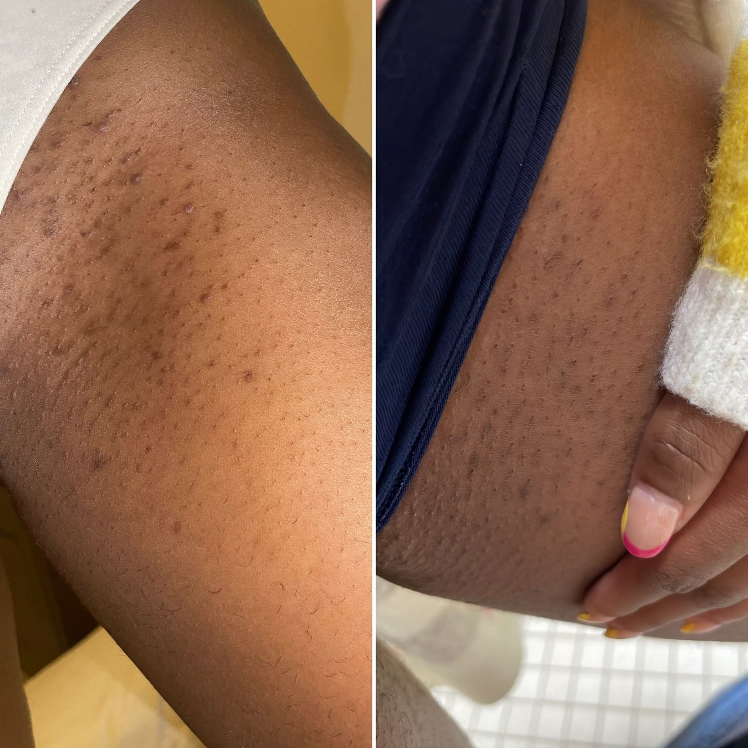 29 - Before and After