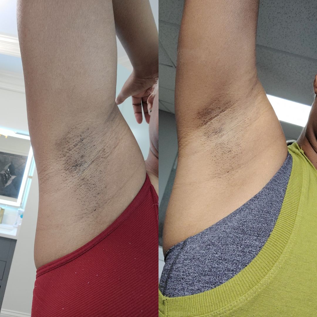 46 - Before & After