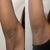 Before and After Underarm Discoloration Bushbalm Dark Spot Oil