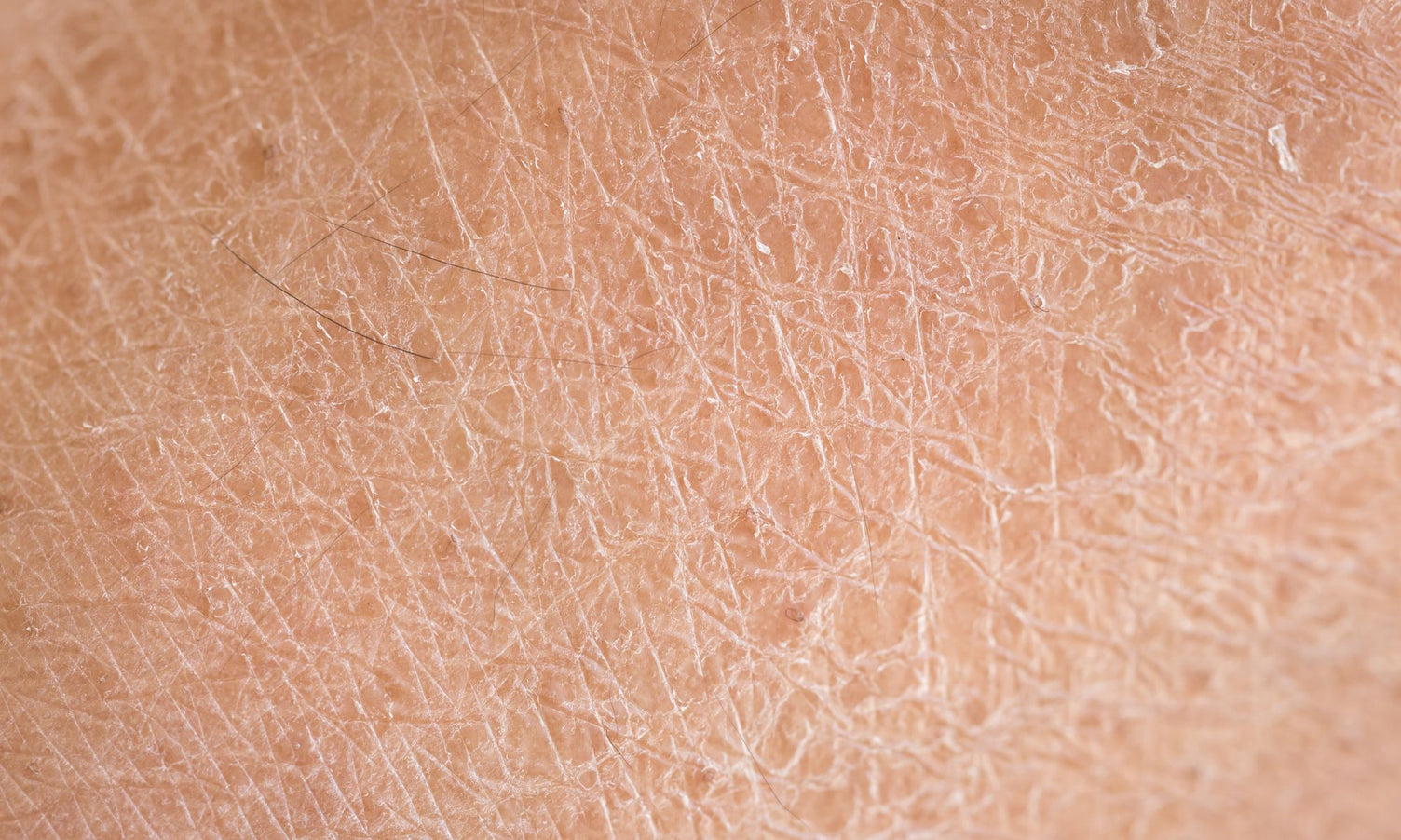 How to maintain a smooth bikini line during dry winter months