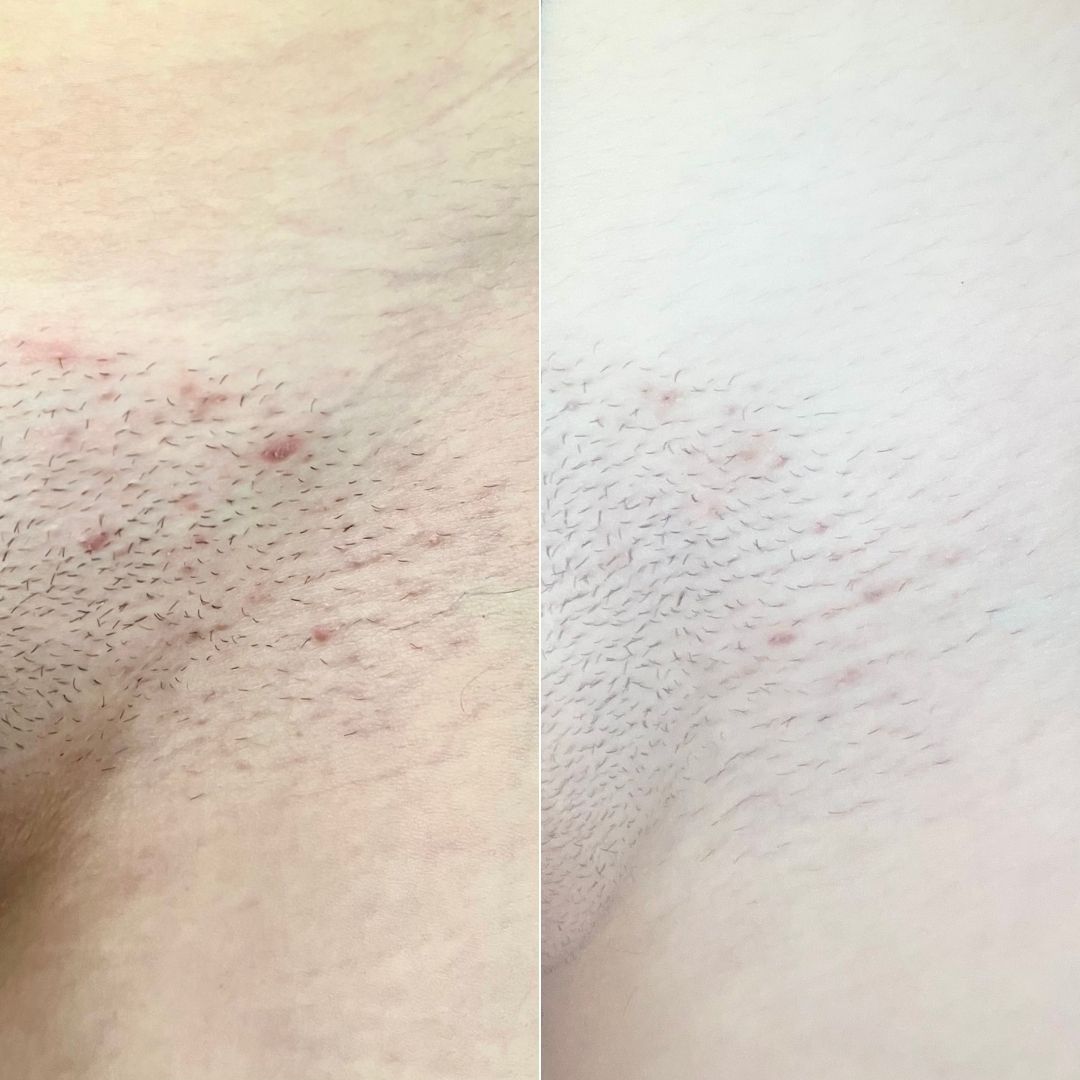 55 - Before & After