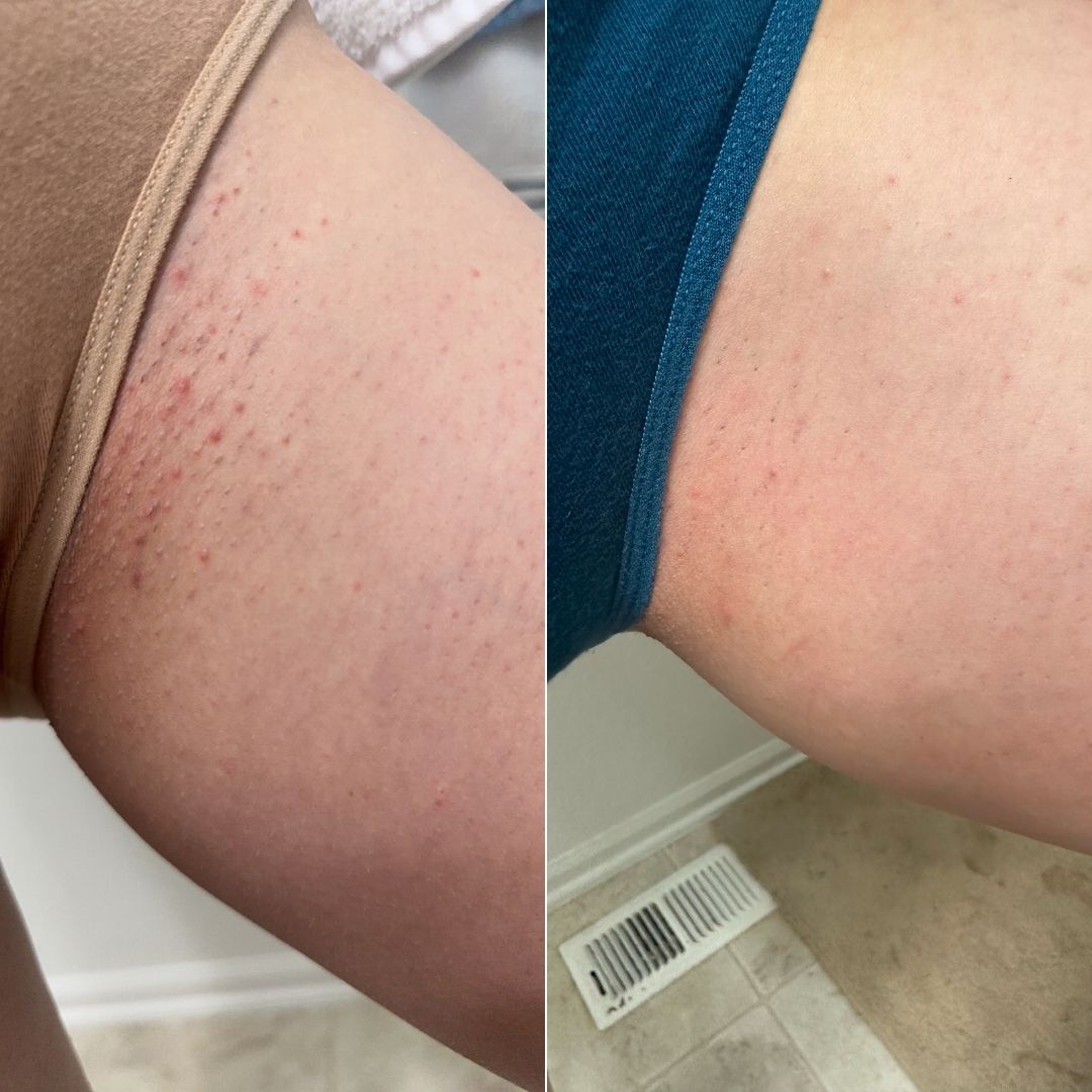 54 - Before & After