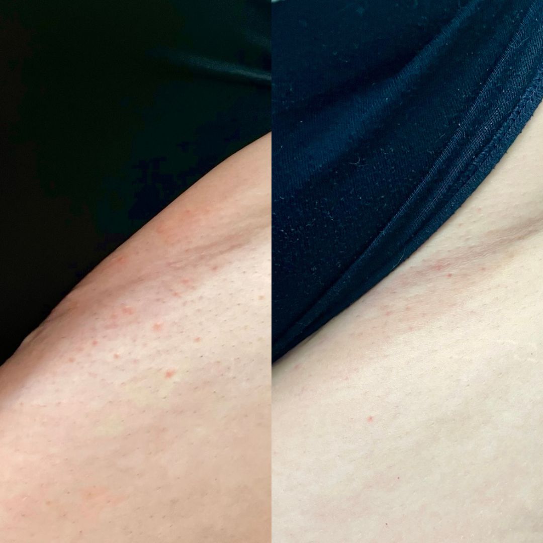 49 - Before & After