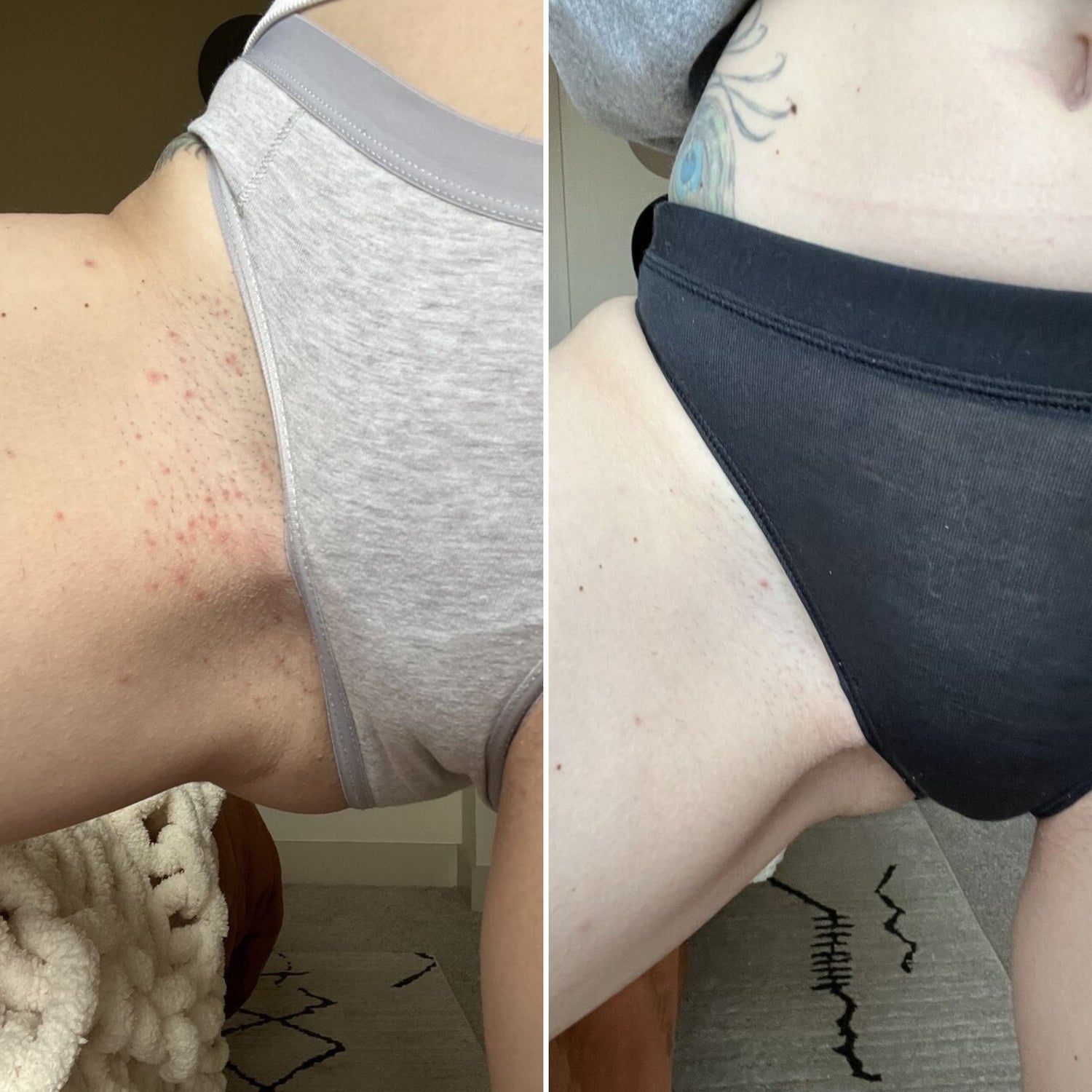 31 - Before and After