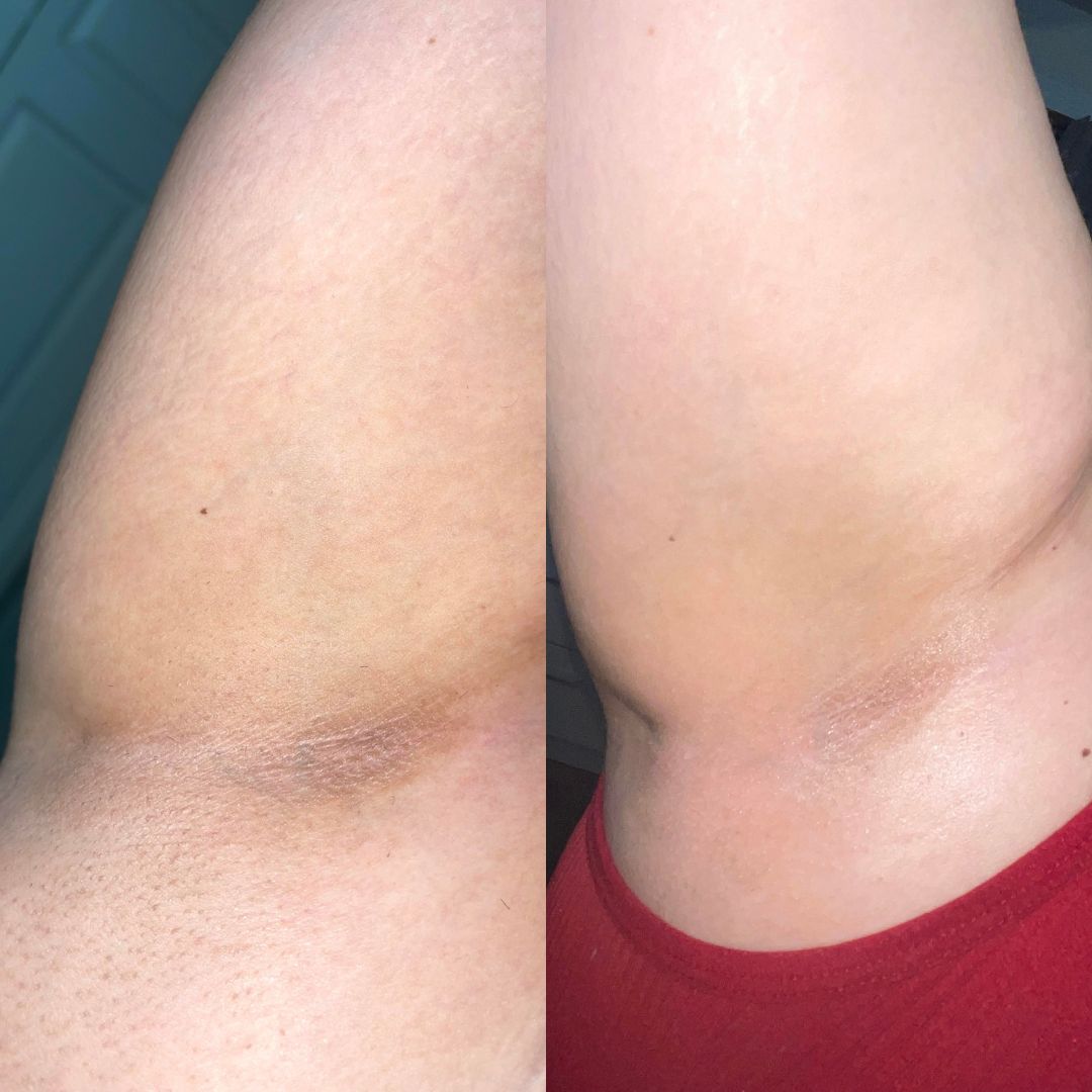 48 - Before & After