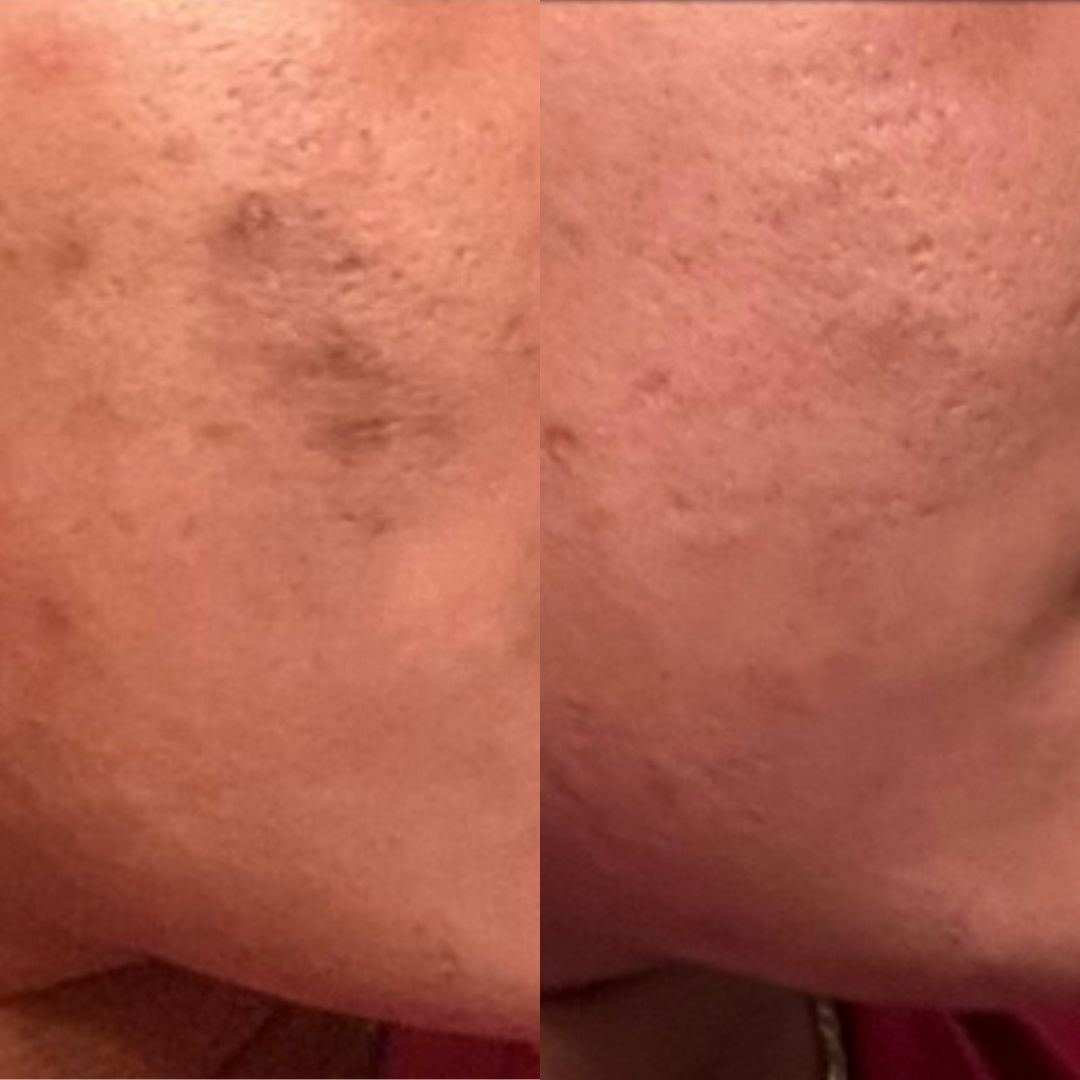 47 - Before & After