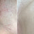 Razor Burn Close up before and after