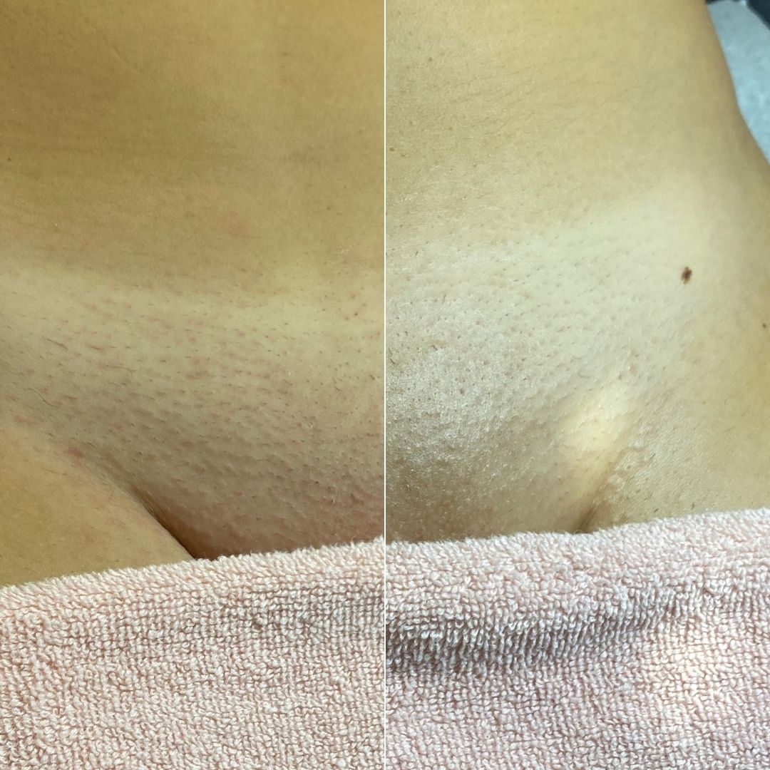 58 - Before & After