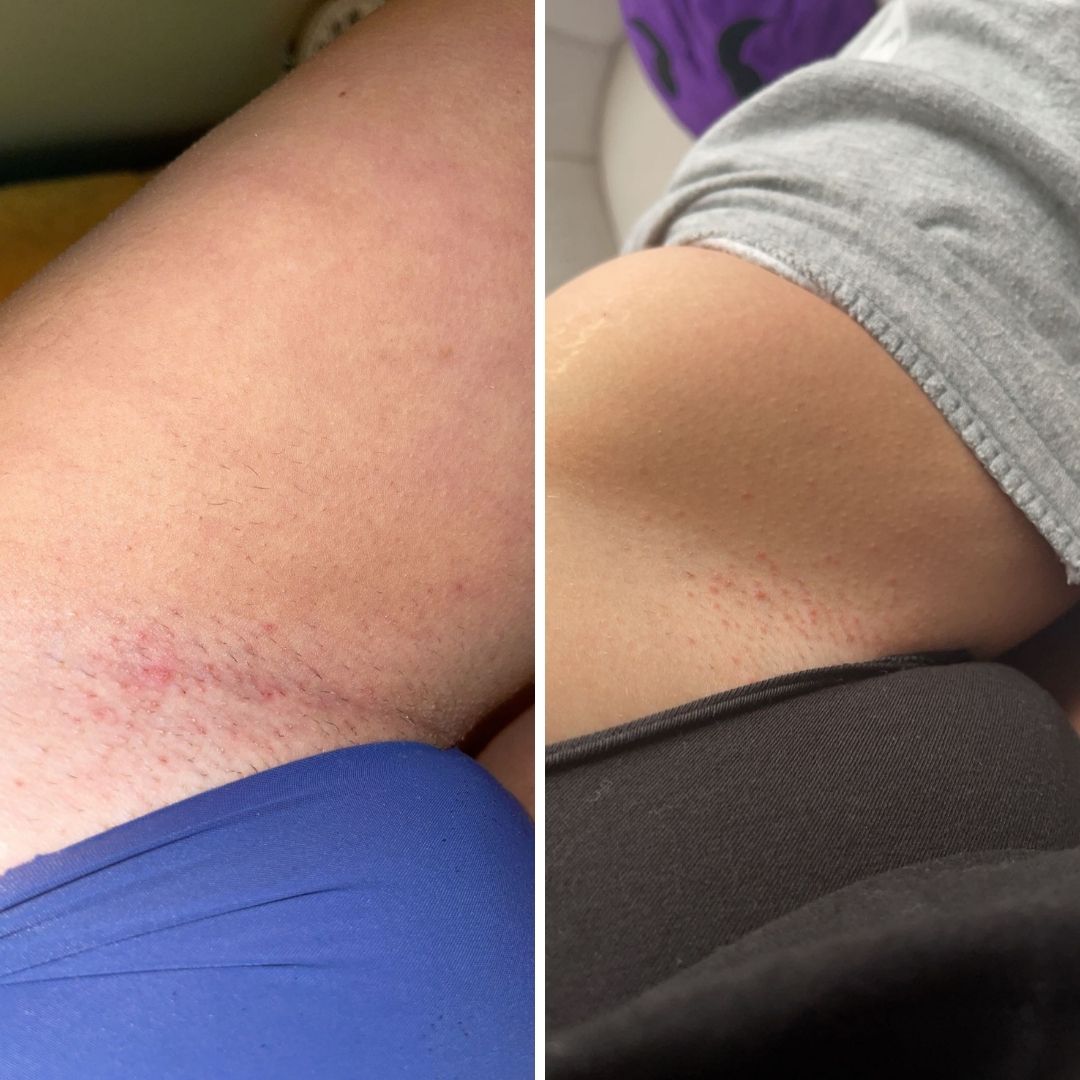 Before & After image closeup Bushbalm