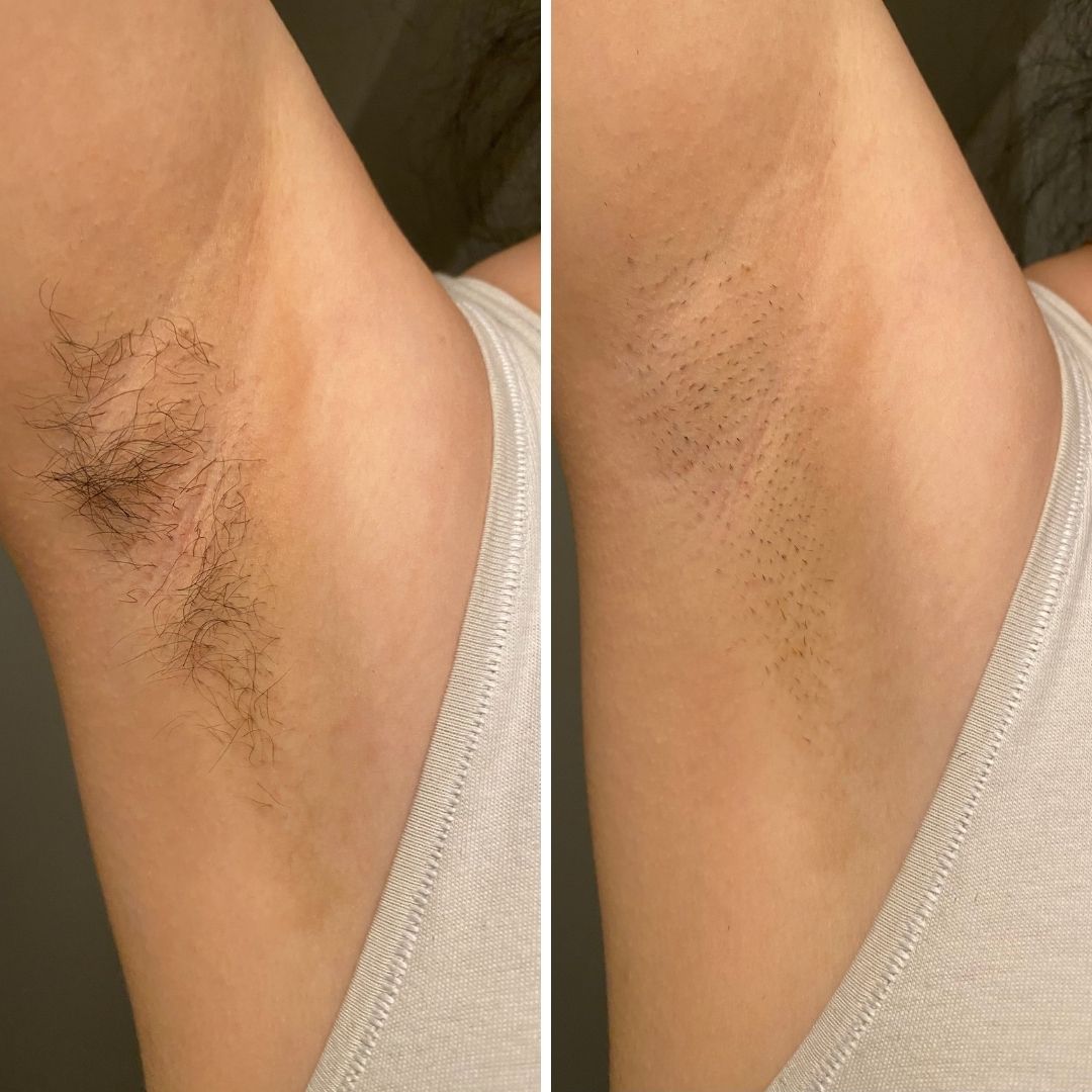 Before & After image closeup Bushbalm