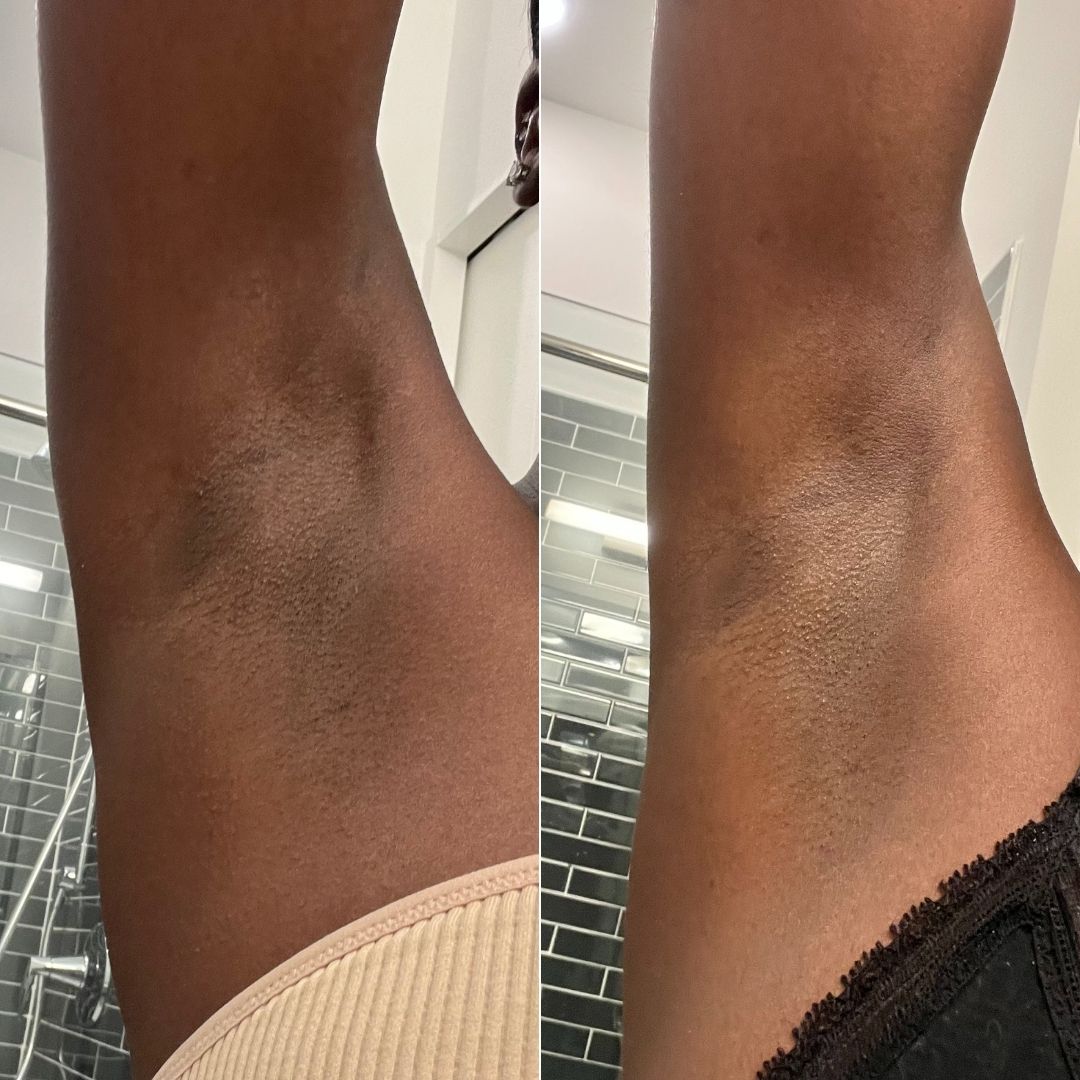 51- Before & After
