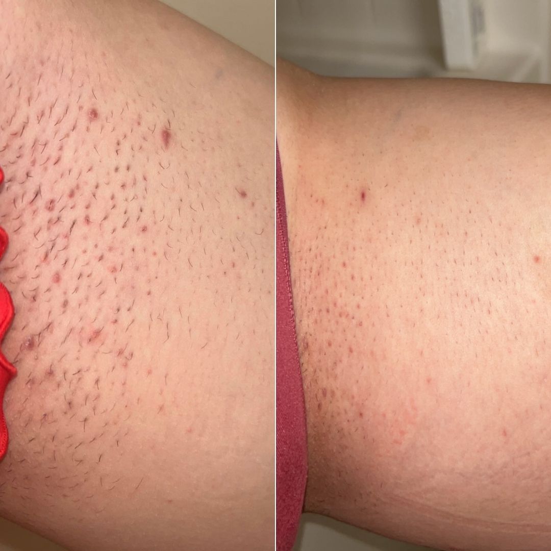 53- Before & After
