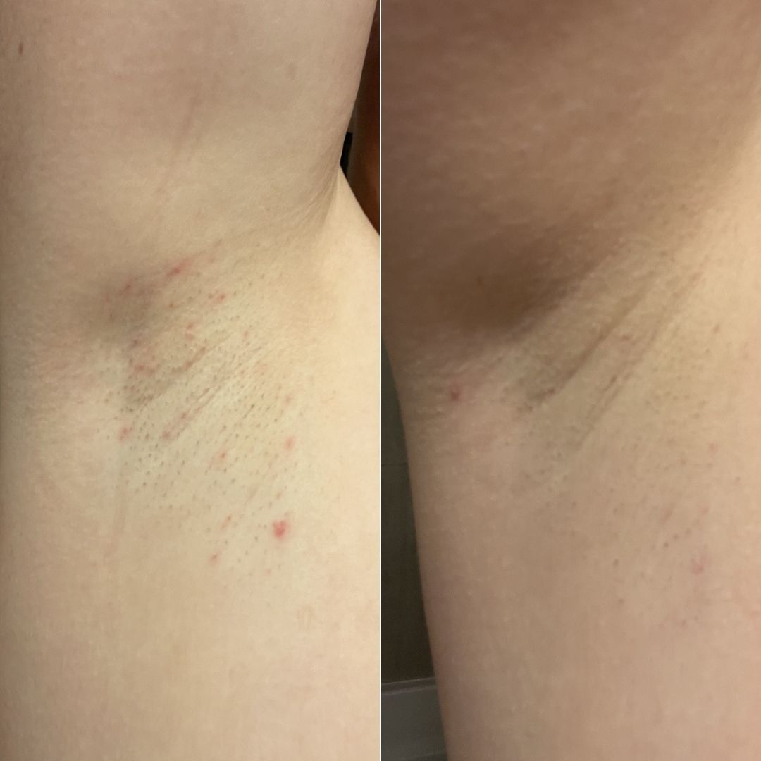 56 - Before & After
