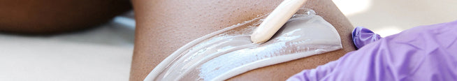 Post-Wax Irritation