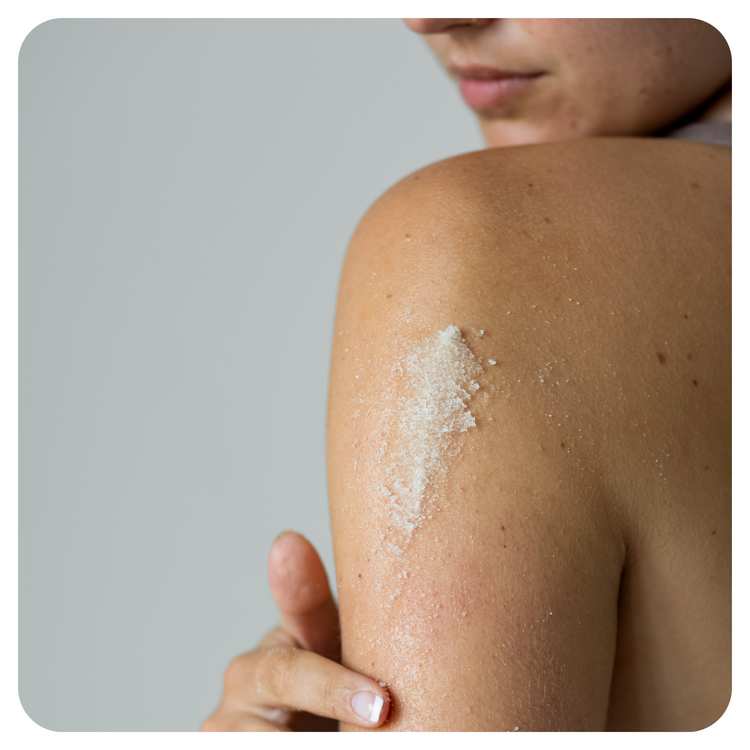 Keratosis Pilaris