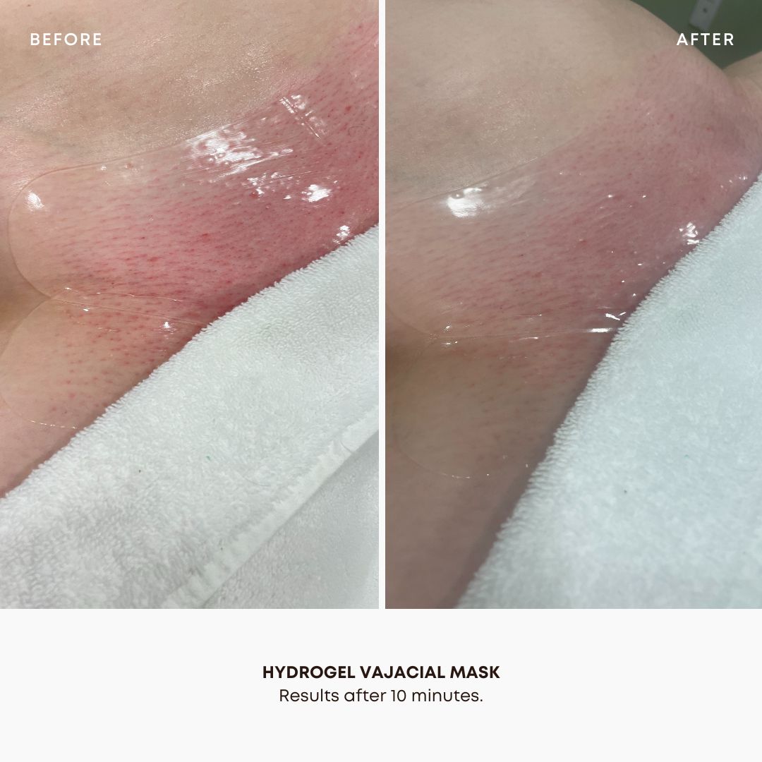 Hydrogel Vajacial Mask Ingredients to combat redness and irritation on the bikini line