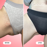 Ingrown Hair Exfoliating Scrub - Watermelon Sugar
