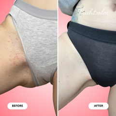 Ingrown Hair Exfoliating Scrub - Watermelon Sugar
