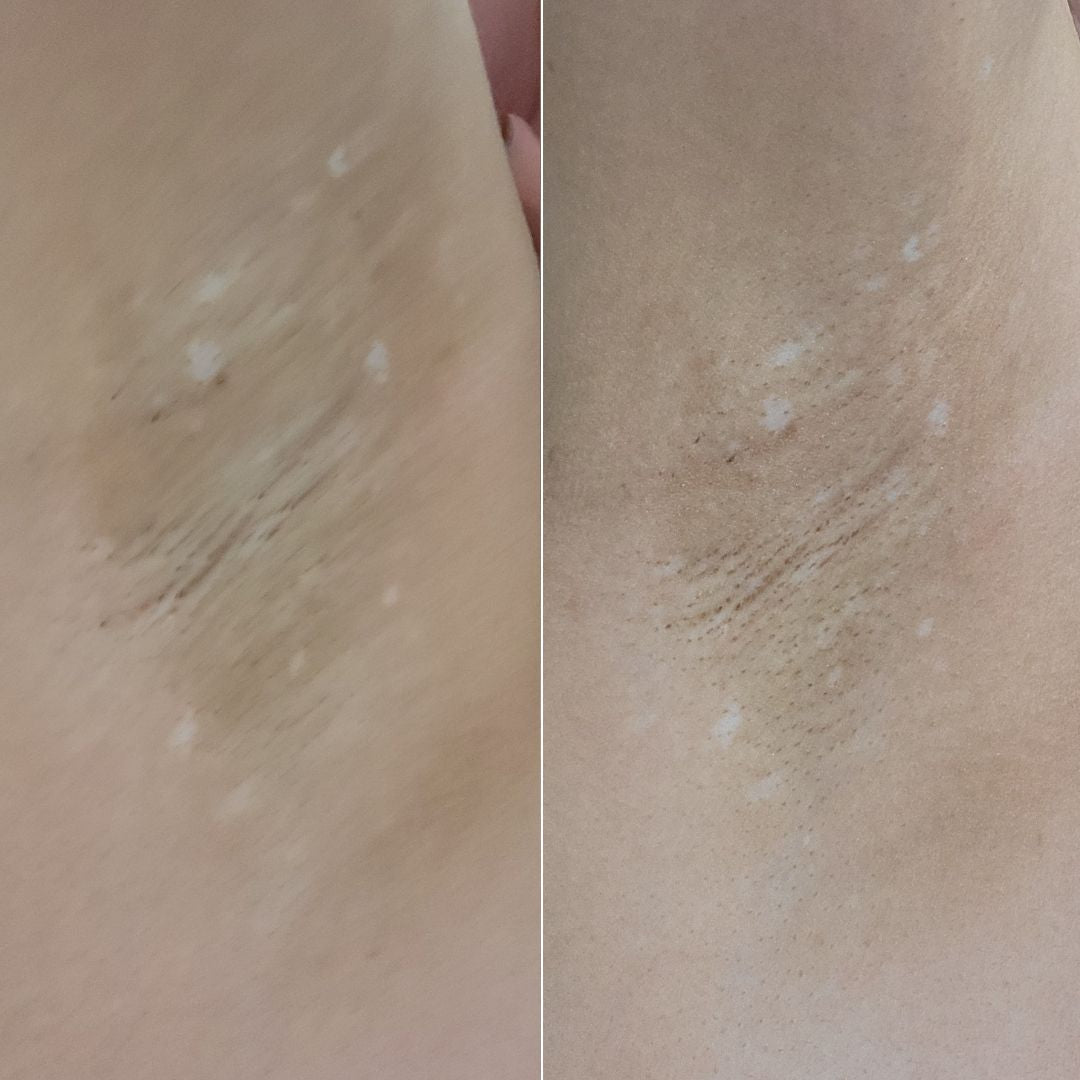 After Dark Underarm Brightening Gel Serum results after using Bushbalm