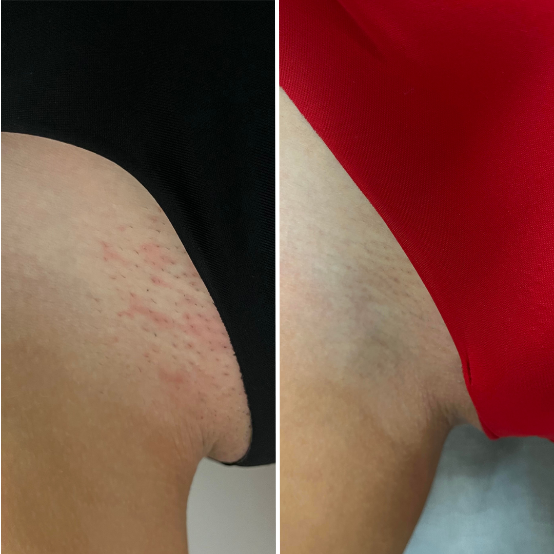 Before & After - Side by Side .png