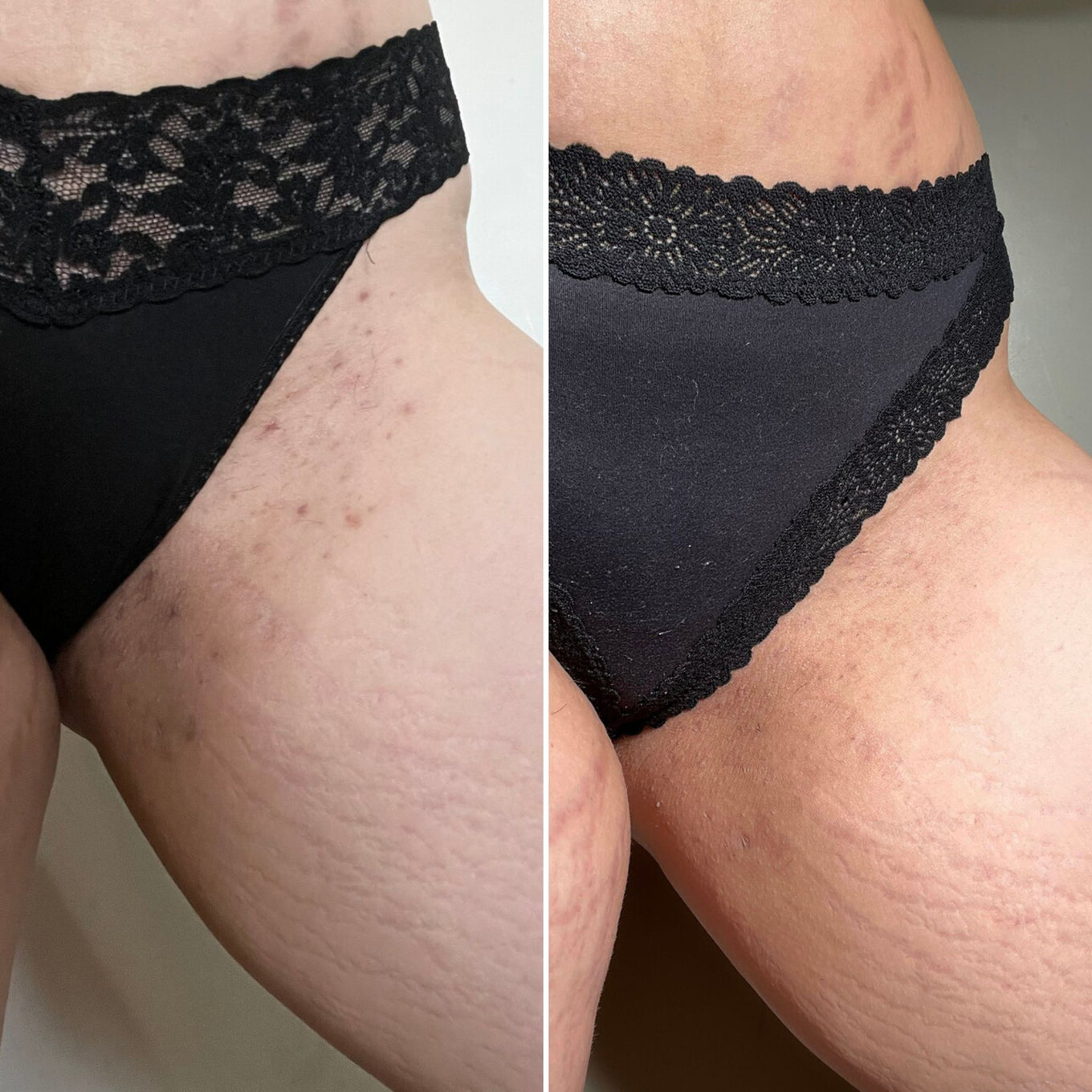 Before and after Bushbalm