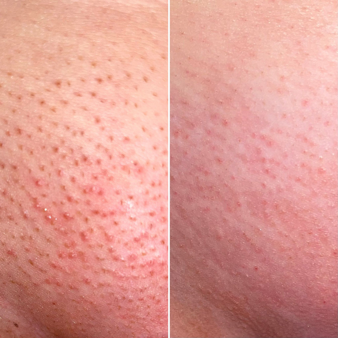 Before and after Bushbalm