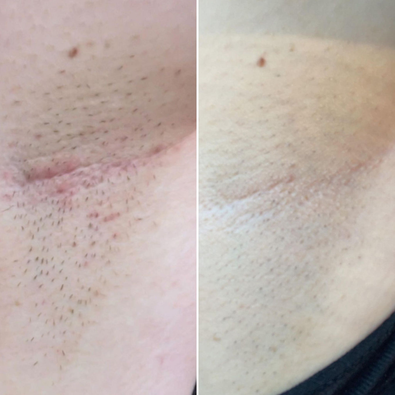 Before and after using Bushbalm