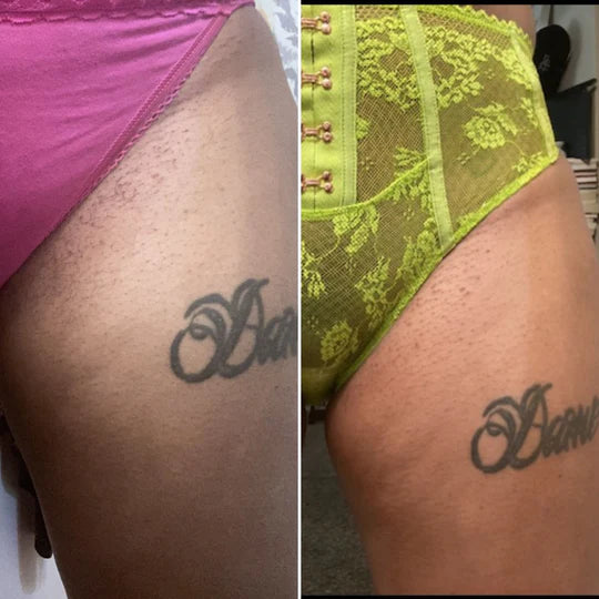 Dark Spots Bushbalm Before and After