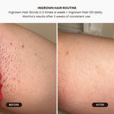 Smooth & Clear Bundle - Watermelon Sugar