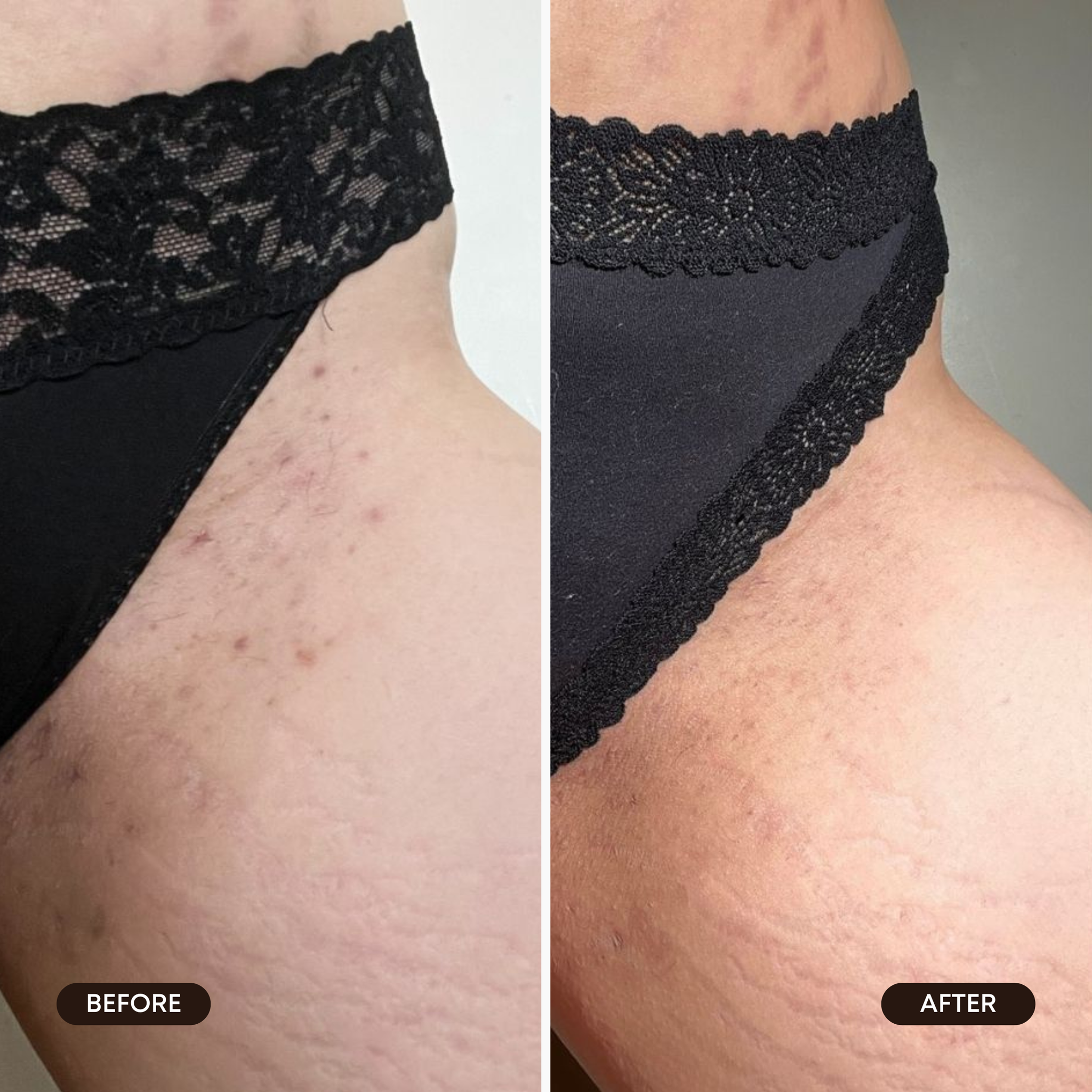 Cozy Cashmere Ingrown Hair Oil Value Pack