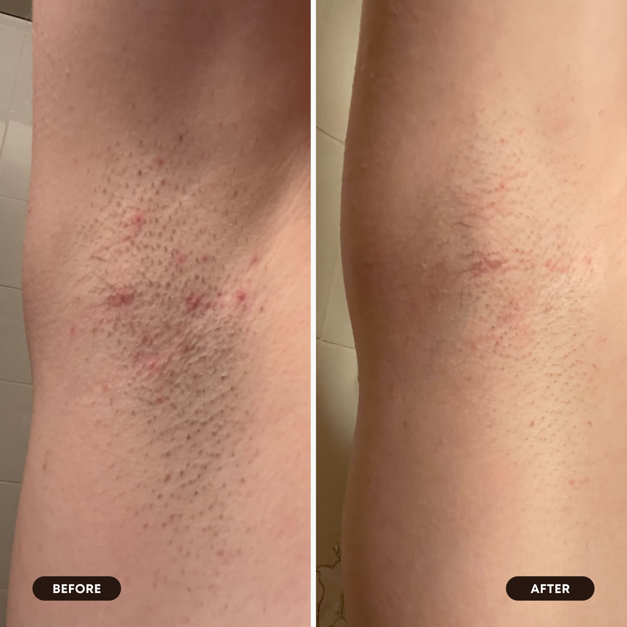 2025 Limited Edition 2-Step Set