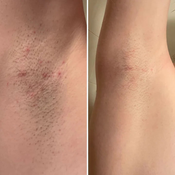 Underarm before and after